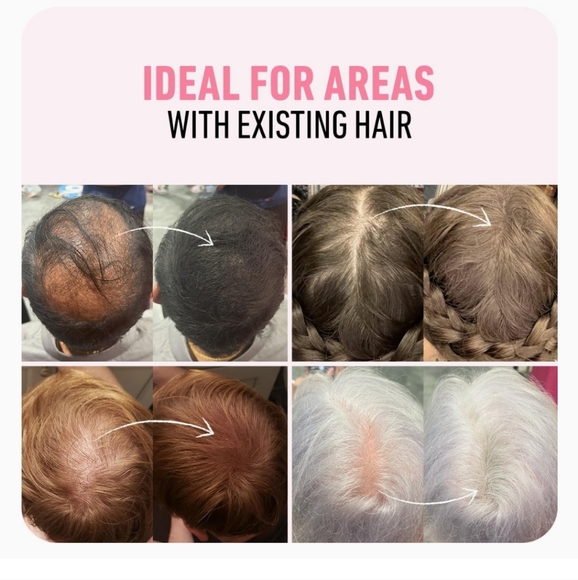 Boldify Hair Thickening - Picture 3 of 7